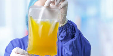 Operatore sanitario con camice e guanti mostra una sacca di plasma giallastro destinata alla donazione